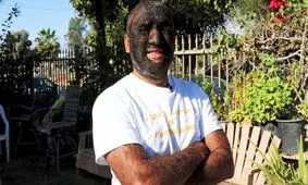 مرد گرگ‌نما؛ پرموترین مرد جهان