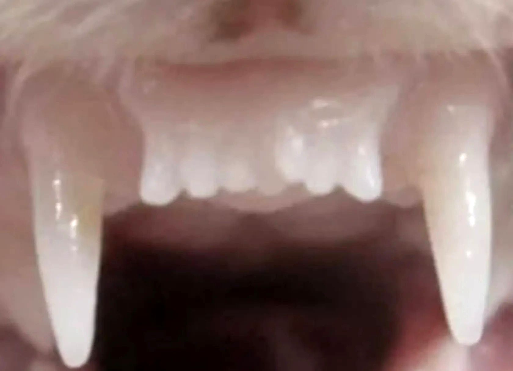 اولین داروی رشد مجدد دندان به زودی روی انسان آزمایش می‌شود