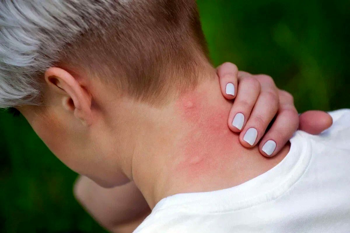 چرا مگس ها جذب انسان میشوند؟