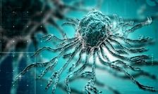 هوش مصنوعی سلول‌های قاتل سرطان را شناسایی می‌کند

