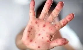 آنفلوآنزای گوجه فرنگی؛ ویروس مرگبار جدید/ بیماری هندی راه‌های متنوعی برای انتقال دارد