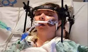 معجزه پزشکی / پیوند مجدد سر زنی که از بدن جدا شده بود