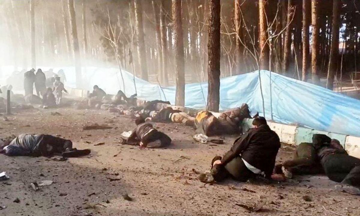 تکههای بدن، کاپشن صورتی، گوشوارههای قلبی، احتمالا دو ساله!