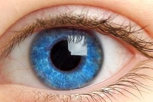 خطرات استفاده از لنز زیبایی چشمی که در سوپرمارکت ها می‌فروشند