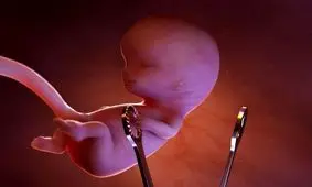 تعطیلی مطب یک ماما در قم به دلیل سقط جنین و توقیف اموال وی

