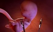 تعطیلی مطب یک ماما در قم به دلیل سقط جنین و توقیف اموال وی

