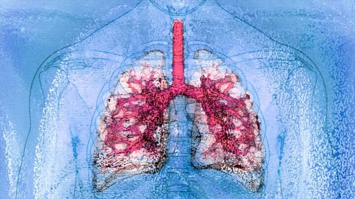 نخستین پیوند همزمان ریه و کبد میان دو فرد HIV مثبت

