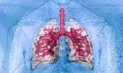 نخستین پیوند همزمان ریه و کبد میان دو فرد HIV مثبت

