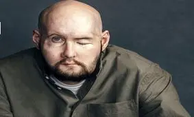 نتیجه اولین عمل پیوند چشم در جهان