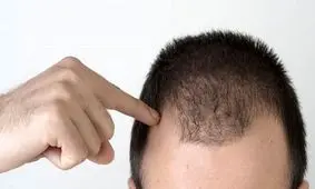 چگونه رشد موهای خود را افزایش دهیم؟