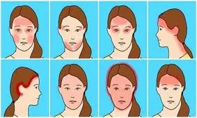 انواع سردرد‌ و روش های درمان آن‌