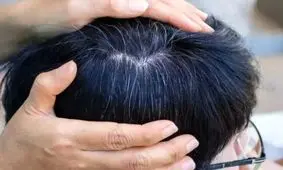 چه عواملی باعث سفید شدن مو می‌شوند؟