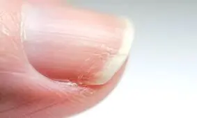 ۶ علامت مهم کمبود روی در بدن