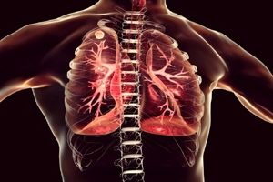 ارتباط کرونای طولانی مدت با بیماری مجاری هوایی کوچک ریه‌ها