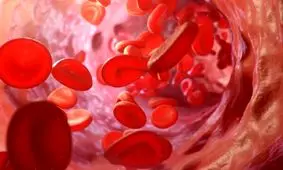 درمان جدید برای مقابله با سرطان خون کودکان