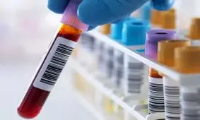 سرعت این دستگاه در تشخیص سرطان باورنکردنی است