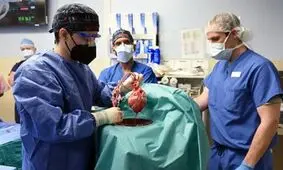 پازل گمشده اولین پیوند قلب خوک به انسان پیدا شد

