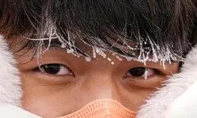 رابطه بین هوای سرد و سکته مغزی