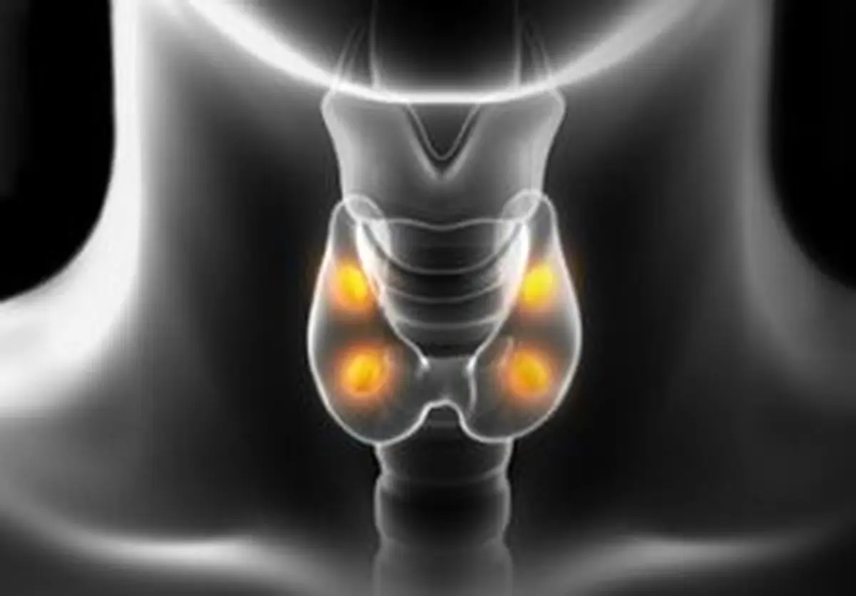 چرا موارد سرطان تیروئید در جهان رو به افزایش است؟