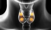 چرا موارد سرطان تیروئید در جهان رو به افزایش است؟