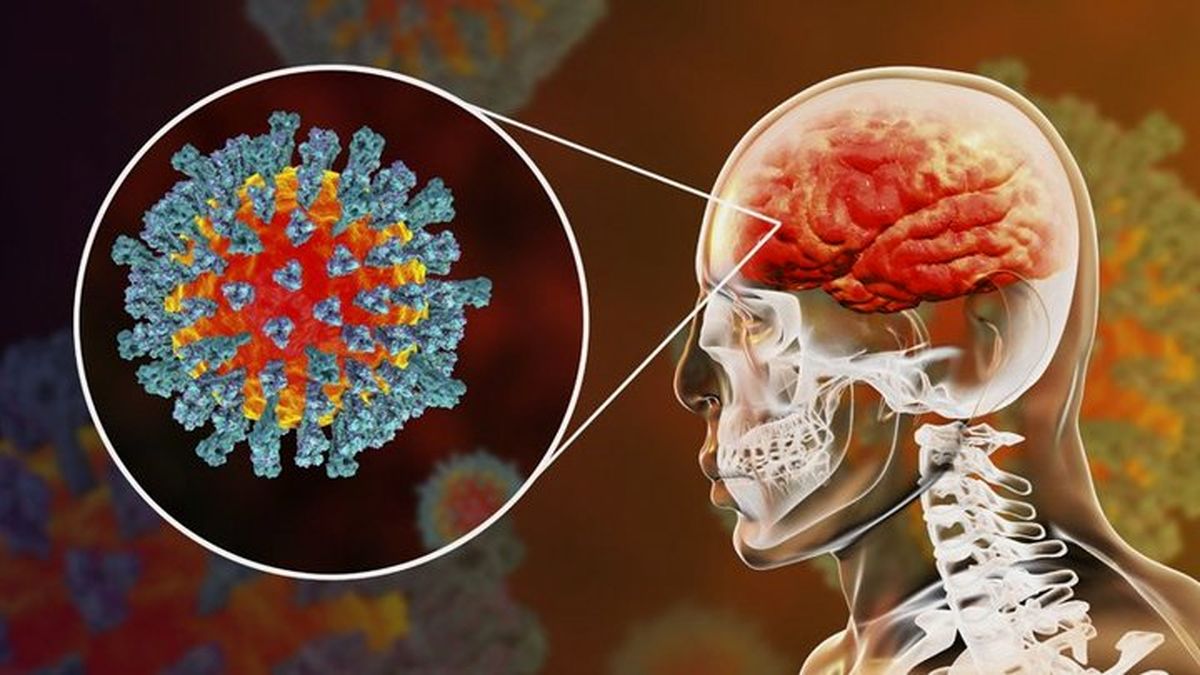 چرا نباید کووید-19 را یک آنفلوآنزای حاد تصور کنیم؟