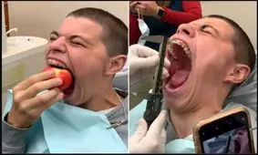 با دهان‌گشادترین انسان آشنا شوید