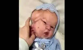 تولد نوزاد عجیب الخلقه هندی با 3 صورت و 3 چشم / ویدئو