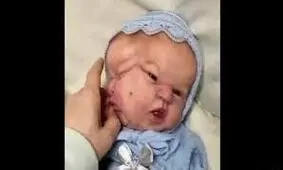 تولد نوزاد عجیب الخلقه هندی با 3 صورت و 3 چشم / ویدئو