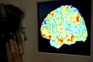 محققان نقش جدید ماده سفید مغز را شناسایی کردند

