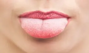 پیوند زبان جدید از ران بیمار مبتلا به سرطان زبان