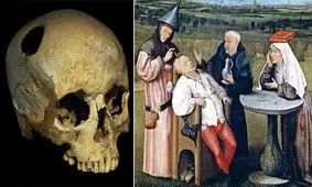 ۱۳ روش درمانی عجیب و غریب در طول تاریخ، از خمیر موش تا مربای جنازه و خون خفاش