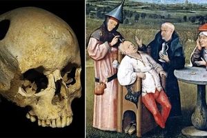 ۱۳ روش درمانی عجیب و غریب در طول تاریخ، از خمیر موش تا مربای جنازه و خون خفاش