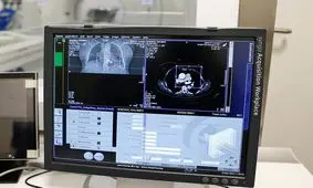 سرطان معده صدرنشین مرگ‌های سرطانی ایران/ ابتلای ۱۵ هزار بیمار جدید