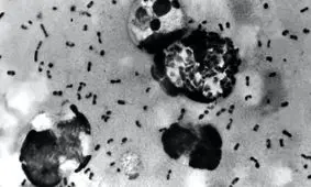 محققان منشاء طاعون سیاه را پیدا کردند