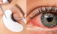 هشدار محققان درباره اکستنشن مژه؛ زیبایی که می تواند به قیمت نابینا شدن تمام شود