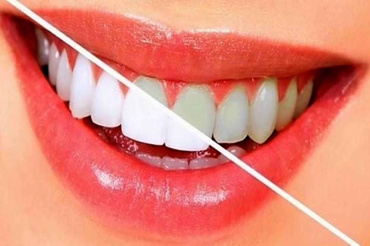 خوراکی هایی که مثل مسواک دندان هایتان را تمیز می‌کنند