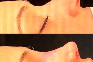 زنان ایرانی بینی کدام خانم بازیگر را دوست دارند؟ / یک دکتر از تغییر نگرش دختران ایرانی به سمت نچرال بودن گفت