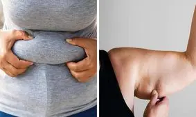 نوع چربی بدن تان درباره سلامت تان چه می گوید؟
