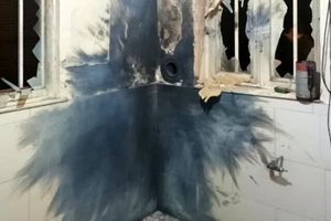 انفجار ترقه جوان شیرازی را راهی بیمارستان کرد