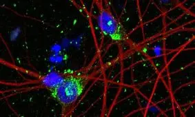 امید به درمان آلزایمر با مدل‌سازی جدید از نورون انسان


