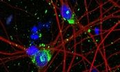 امید به درمان آلزایمر با مدل‌سازی جدید از نورون انسان

