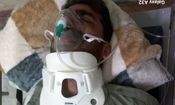 محیط‌زیست: ضرب و جرح شدید یک محیط‌بان در حین مأموریت توسط دامدار متخلف/ متهم با ده‌ها ضربه چوب، به سر، صورت و بدن وی حمله‌ور شد