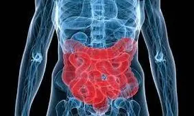 ۵ خوراکی مضر برای سلامت روده