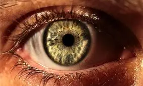 ابداع لنزهایی که خراش‌های خود را ترمیم می‌کنند

