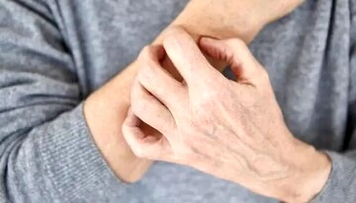 این نشانه ها یعنی بیماری پوستی