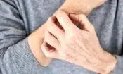 این نشانه ها یعنی بیماری پوستی