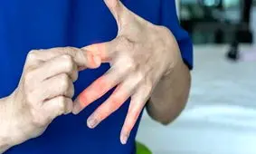 هشدار درباره بی حسی و درد انگشتان
