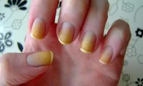 درمان خانگی زردی ناخن