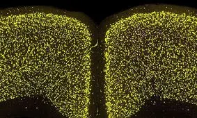 «اثر انگشت» عامل پارکینسون، شناسایی شد

