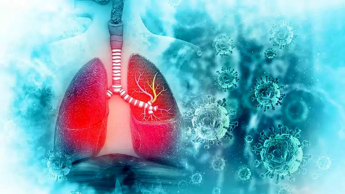 ذات الریه مرگبار با منشا ناشناخته در آرژانتین